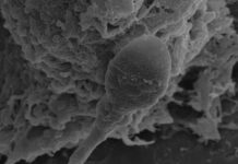 Людські Сперматозоїди Зазнають Труднощі з Навігацією в Космосі, Виявили Дослідники