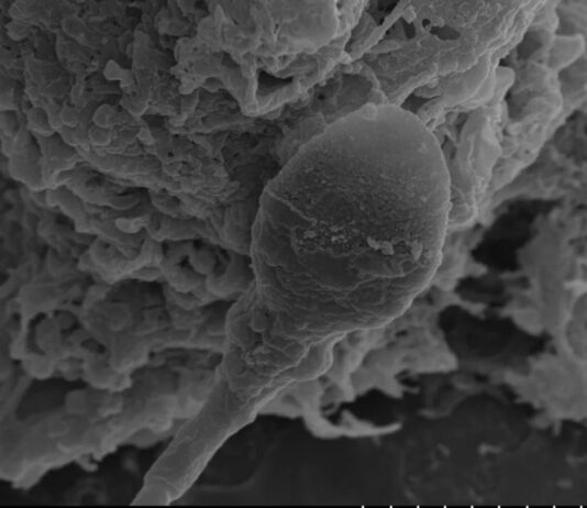 Людські Сперматозоїди Зазнають Труднощі з Навігацією в Космосі, Виявили Дослідники