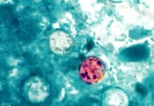 Не їжте айсберг-салат у Taco Bell: CDC підтверджує спалах циклоспоридіозу