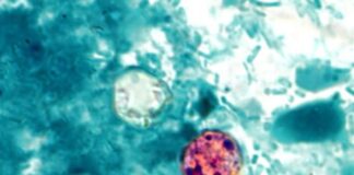 Eet geen ijsbergsla bij Taco Bell: CDC bevestigt uitbraak van cyclospora