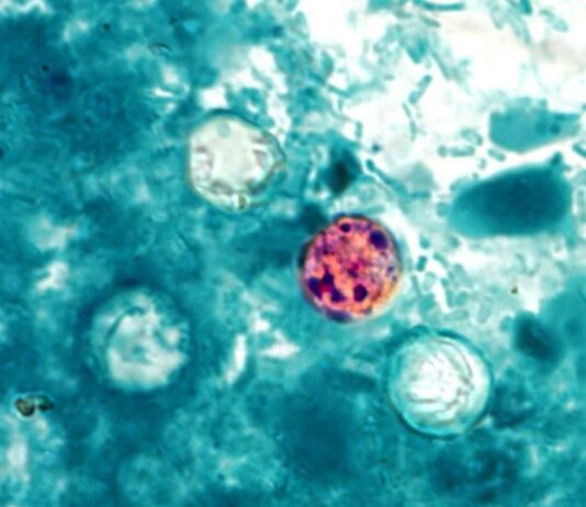 Nie jedz sałaty lodowej w Taco Bell: CDC potwierdza epidemię cyklosporydiozy